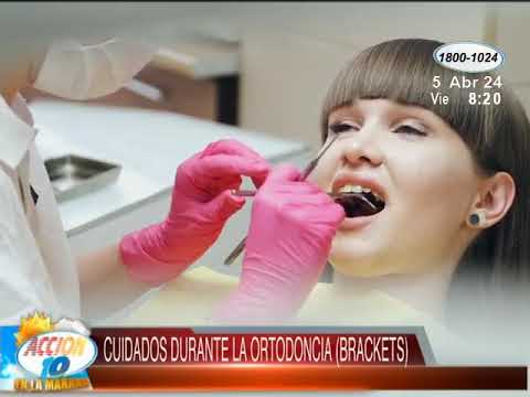 Consulta con el Especialista: Cuidados durante la ortodoncia