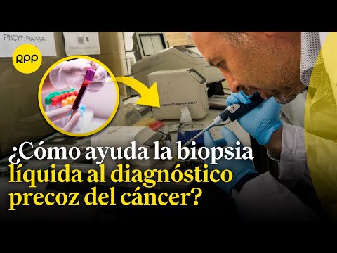 Biopsia líquida: ¿Qué es y cómo puede ayudar en el diagnóstico precoz del cáncer?