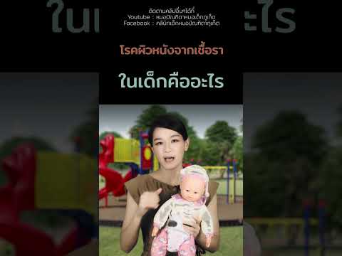 โรคผิวหนังเด็กลูกติดเชื้อราโ