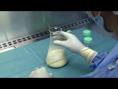 La leche materna de las pacientes con cáncer de mama contiene ADN del tumor