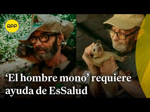 Orlando Zagazeta, 'El hombre mono', requiere ayuda de las autoridades de EsSalud