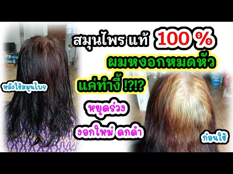 ผมหงอก-บาง-ร่วง-หัวล้าน-รัวแค- ผมหงอก-บาง-ร่วง-หัวล้าน-รัวแค-