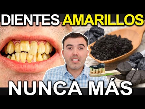 DIENTES AMARILLOS ALERTA TIENES QUE SABERLO! - Causas Y Enfermedades Que Lo Producen Y Como Eliminar