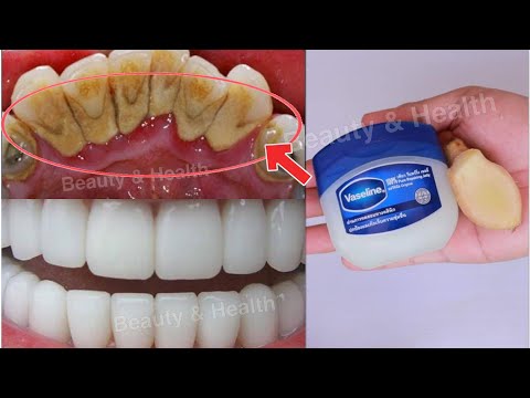 แก้ฟันเหลืองใน-2-นาทีฟันขาวจาก แก้ฟันเหลืองใน-2-นาทีฟันขาวจาก