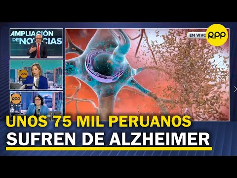 ALZHEIMER: 4 de cada 100 peruanos mayores de 65 años padece esta enfermedad