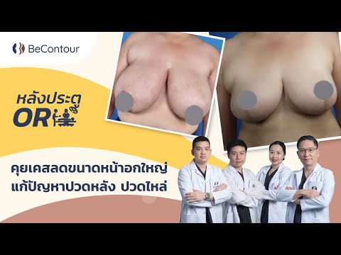 ลดขนาดหน้าอกใหญ่แก้ปัญหาปวดหล