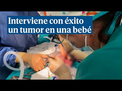 Interviene con éxito un tumor en una bebé que todavía estaba en periodo de gestación