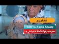 ابتسامة جديدة لـ50 طفلًا.. عمليات مجانية للشفة الأرنبية في إب