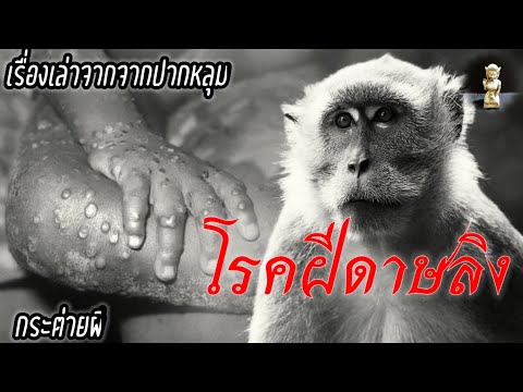 โรคฝีดาษลิงอาการโรคฝีดาษลิงร