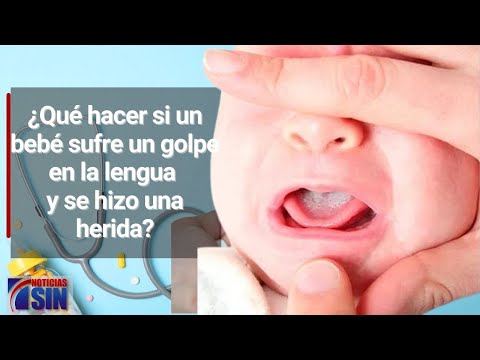 Recomendaciones si un bebé sufre heridas en su lengua