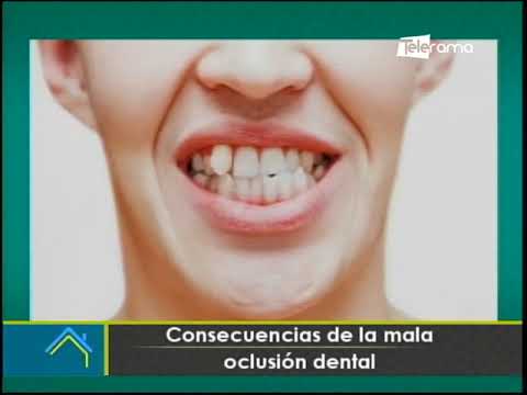 Consecuencias de la mala oclusión dental