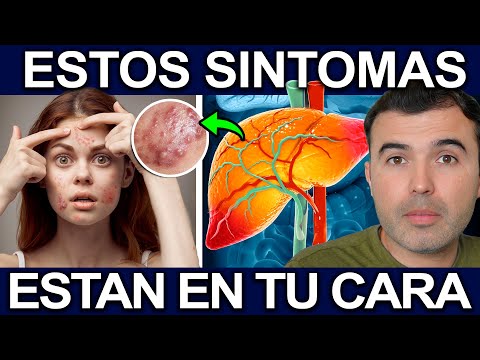 6 FORMAS EN QUE TU ROSTRO MUESTRA ENFERMEDADES   Signos Y Sintomas En La Cara