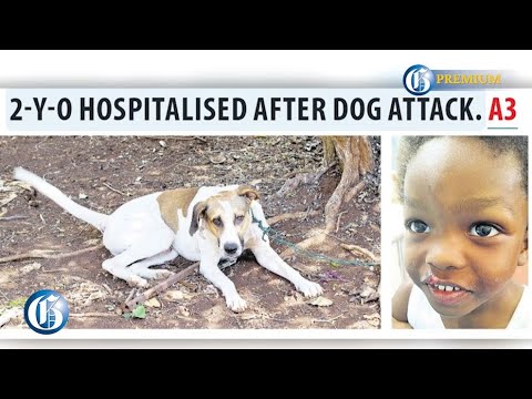Two-year-old hospitalised after dog attack