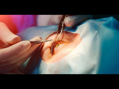 ¿Cómo recupero la vista sin cirugías invasivas?