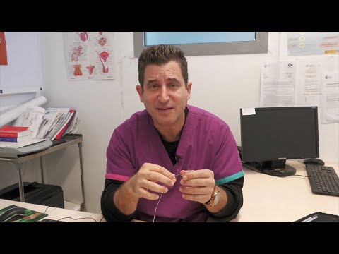 La i-TIND, una técnica realizada en el Hospital para la hiperplasia benigna de próstata