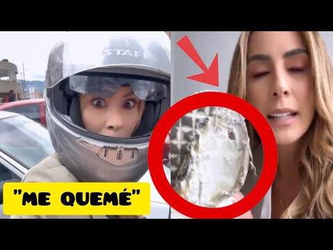 Carolina Soto SUFRIÓ UNA FUERTE QUEMADURA por NO SABER montar MOTO.