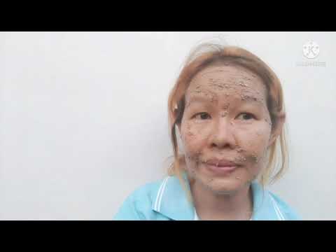 ส่วนผสมแรงดีกว่าโบท็อกซ์ลดริ้ว ส่วนผสมแรงดีกว่าโบท็อกซ์ลดริ้ว