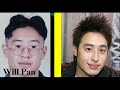 Taiwan Star Wilber Pan Before After Plastic Surgery