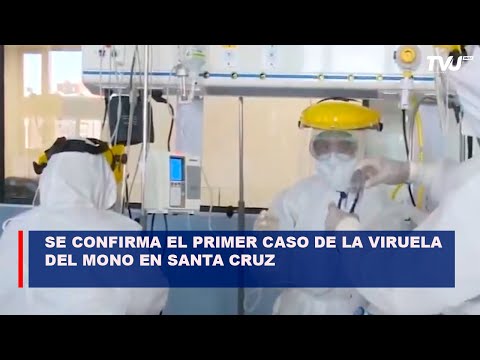 Se confirma el primer caso de la viruela del mono en Santa Cruz