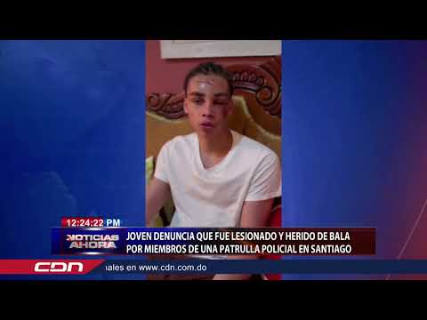 Joven denuncia que fue lesionado y herido de bala por miembros de una patrulla policial en Santiago