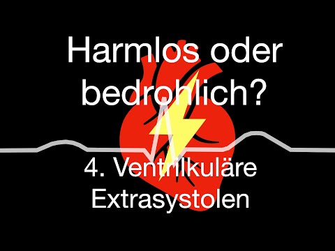 Herzrhythmusstörungen zwischen harmlos oder bedrohlich: 4. ventrikuläre Extraschläge