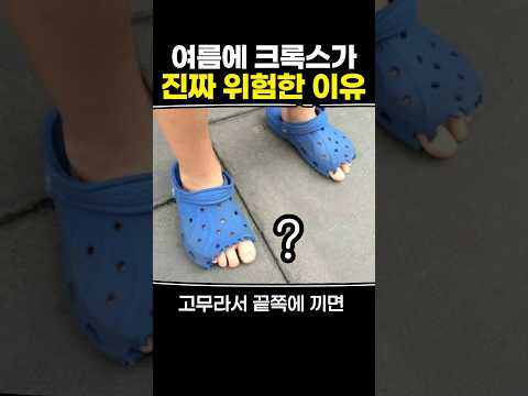 여름에 크록스가 진짜 위험한 이유