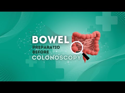 SIKARIN HOSPITAL EssentialGuide:PreparingforYourColonoscopy