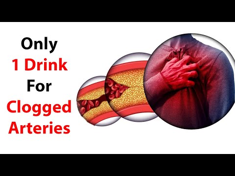 Only 1 Drink For Clogged Arteries In Heart | Unclog Arteries Naturally