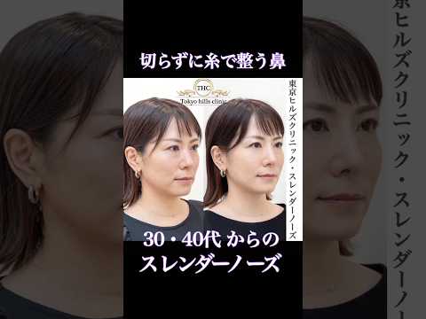 切らずに理想の鼻へ✨30・40代からの 《 スレンダーノーズ 》 🥰 #美容 #鼻整形 #東京ヒルズクリニック #スレンダーノーズ