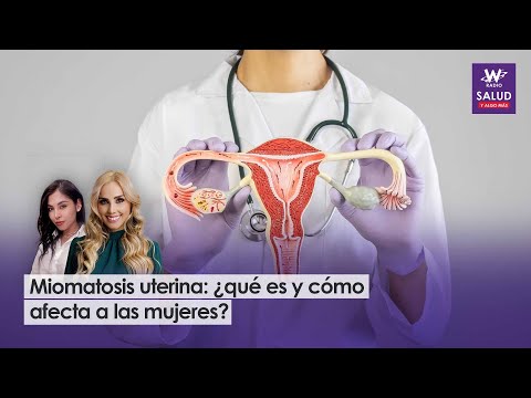 Miomatosis uterina: ¿qué es y cómo afecta a las mujeres?