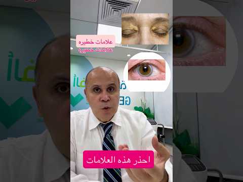 قوس الشيخوخه ..علامه خطيره جدا #دكتور_خالد_ابوالعزم #مرضالسكري