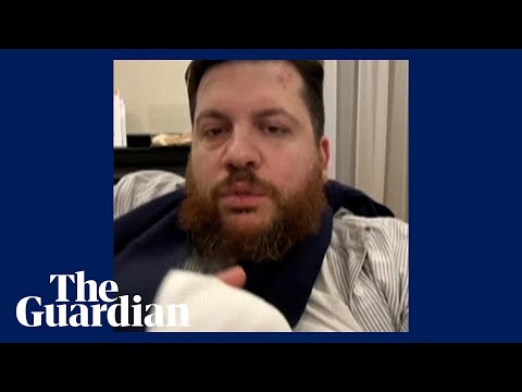 Navalny ally vows to keep fighting Putin after hammer attack