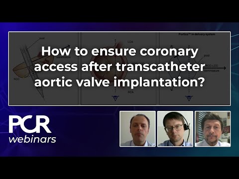 How to ensure coronary access after transcatheter aortic valve implantation? – Webinar