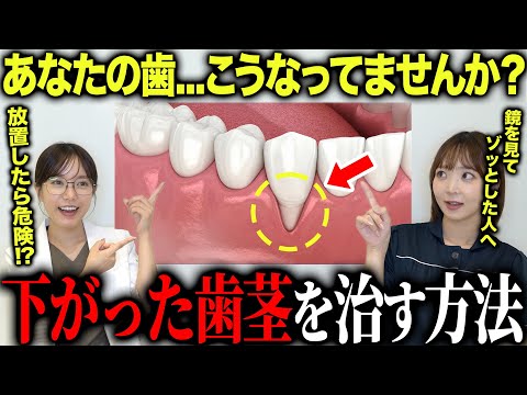 【危険】加齢で歯茎が下がると歯は抜ける！？歯肉退縮を治す最新の方法を教えます！