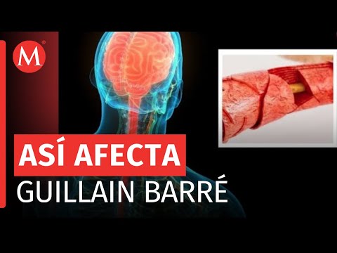Ante riesgo de Guillain Barré, piden prevención y adecuada manipulación de alimentos