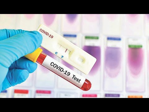 Abre sitio gratuito de pruebas de coronavirus en la frontera EEUU Mexico