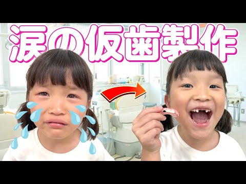 【仮歯作り】歯医者さんはやっぱり怖かった…?!🥹 #ののちゃん
