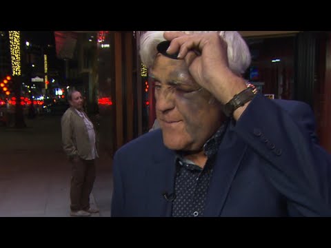 Jay Leno Gets Swollen Eye After Falling Down 60-Foot Hill