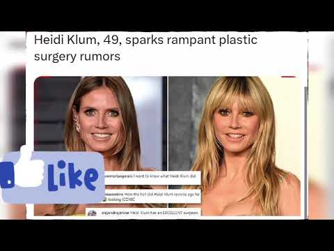 Heidi Klum, 49, sparks rampant plastic surgery rumors