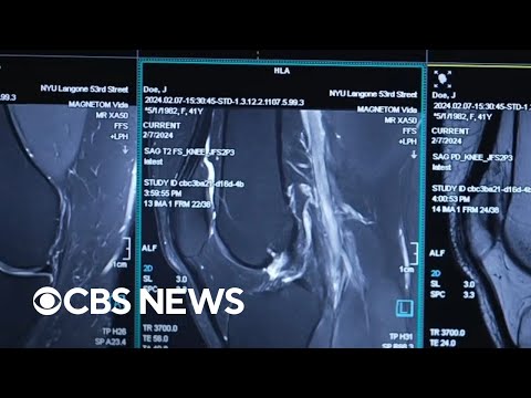 Breakthrough MRI technology uses AI for faster scans