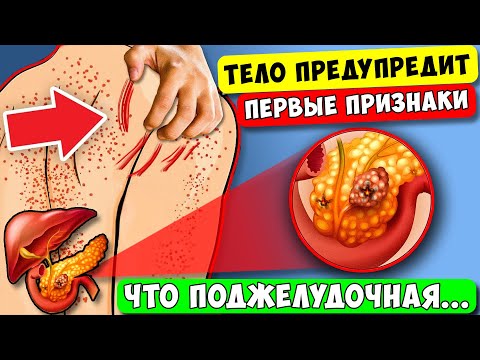 Тело кричит, что ПОДЖЕЛУДОЧНАЯ Отмирает ! Супер Еда для ПОДЖЕЛУДОЧНОЙ ЖЕЛЕЗЫ