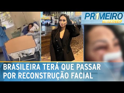 Turista brasileira espancada no Chile recebe alta médica | Primeiro Impacto (03/07/24)