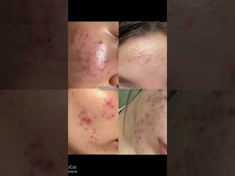 You are beautiful no matter what you look like. #beauty #beautiful #awesome #fypシ゚viral #fyp