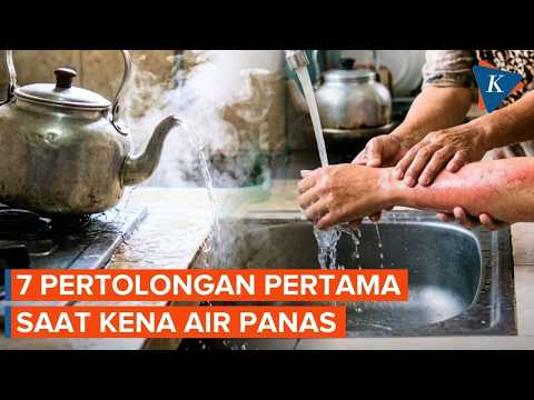Pertolongan Pertama Kena Air Panas