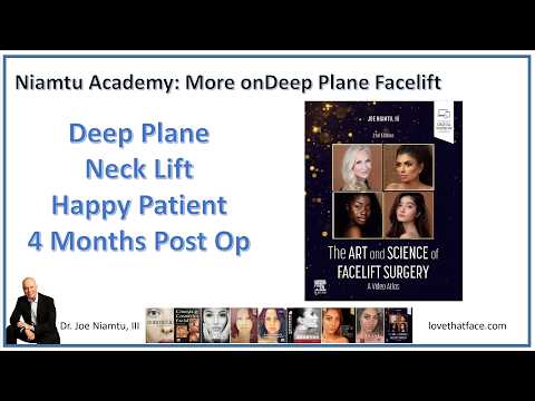 Deep Plane Facelift 4 Months Later: Happy patient and Happy Surgeon