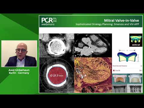 Transcatheter Mitral Valve-in-Valve: a safe alternative for an increasing patient population