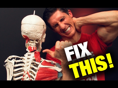 How to Fix a Stiff Neck in Seconds (THIS WORKS!)