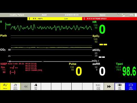 Anesthesia Scenario