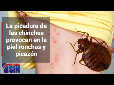 Chinches amenazan con propagarse en el Gran Santo Domingo