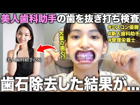 美人すぎる新人歯科助手の歯を仕事中に抜き打ち検査で歯石除去したら口の中がまさかの状態だった！？